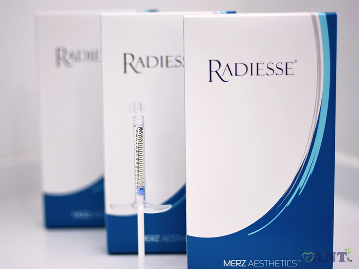 radiesse filler